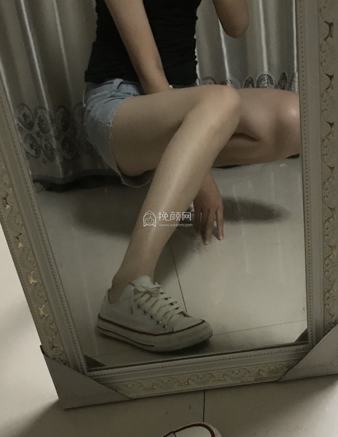 长沙三和医疗美容大腿吸脂好吗?案例