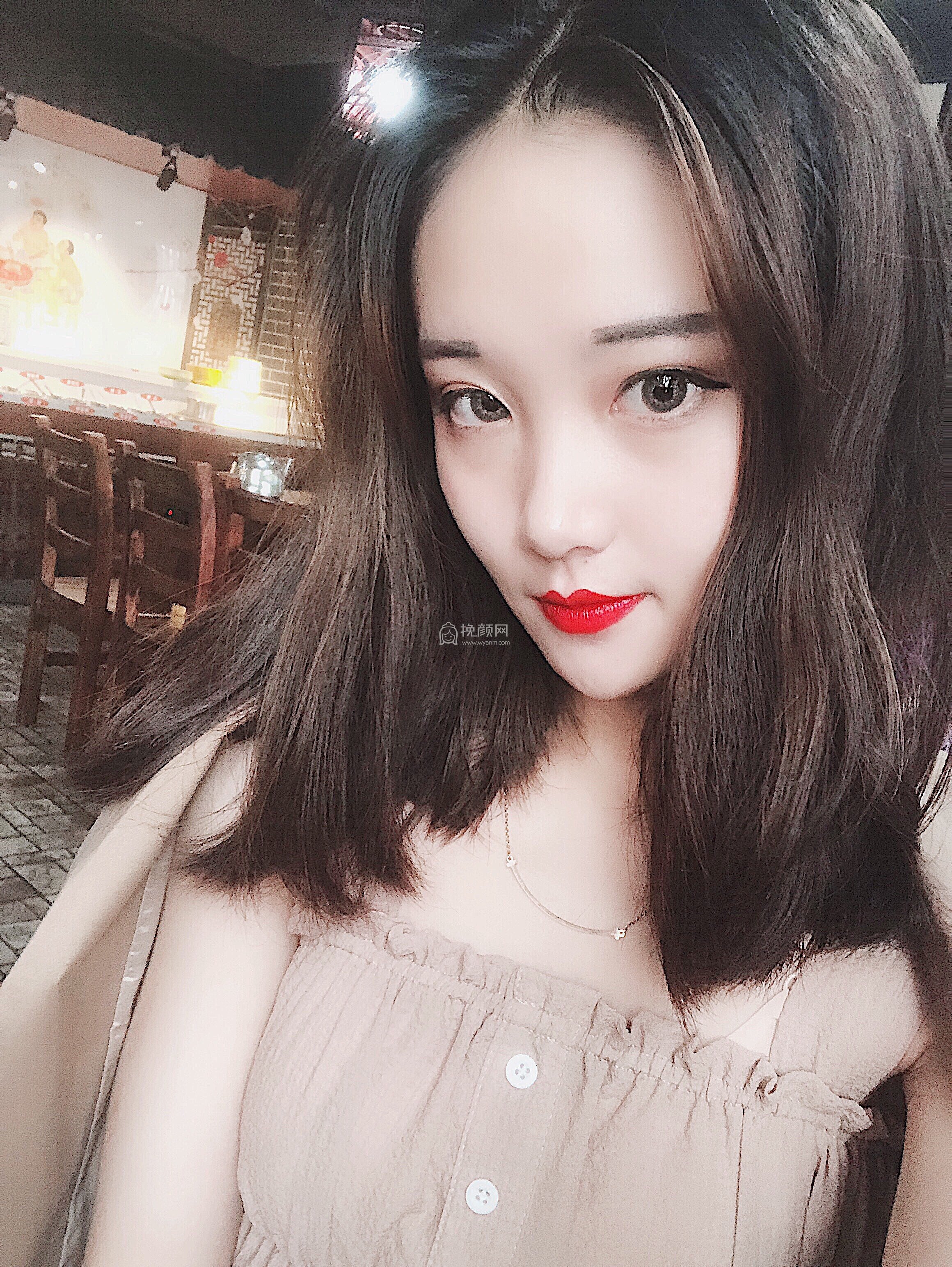 成都天使之翼尤军面部脂肪填充好吗?案例
