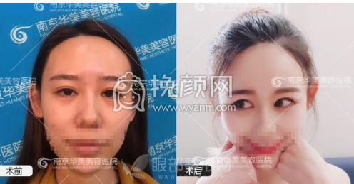南京刘宁、王金明、李昌、王小林哪个医生做双