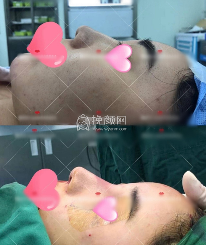 医院医生攻略 | 北京隆鼻医院医生测评