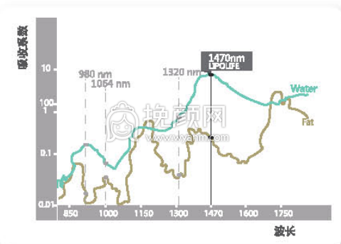 广州韩妃的5G光雕吸脂技术怎么样?