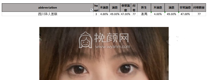 成都三医院的叶飞轮双眼皮如何?