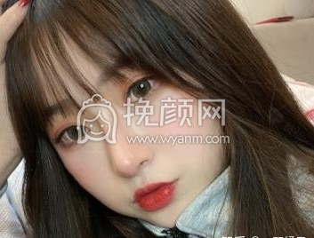 济南省立医院薛峰、高峰、赵鲁彬隆鼻谁更好?
