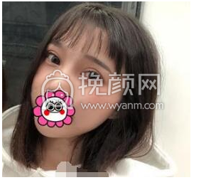 成都李正勇、徐敦、于晓波谁做双眼皮更好?|价
