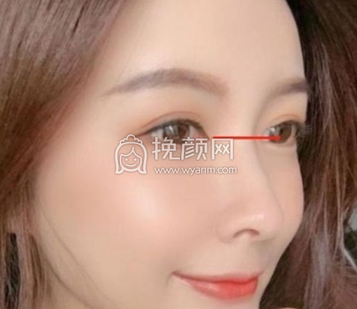 石家庄美莱齐一帆做双眼皮和鼻部手术怎么样?