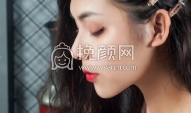汕头第一附属医院找任帅医生全切双眼皮案例|