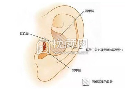 武汉协和整形钟爱梅医生做耳软骨隆鼻果怎么