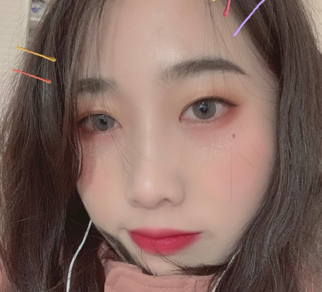 上海九院王梓医生双眼皮整形案例|果|价格