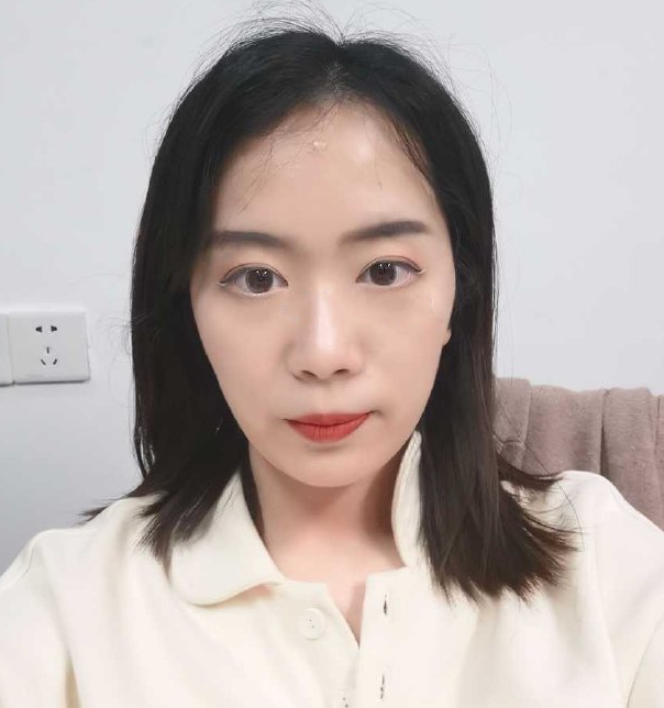 下半张脸挺灾难的,垫下巴整牙还是磨骨削骨呢