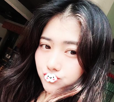 成都美莱黄小林做双眼皮手术怎么样?果|案例