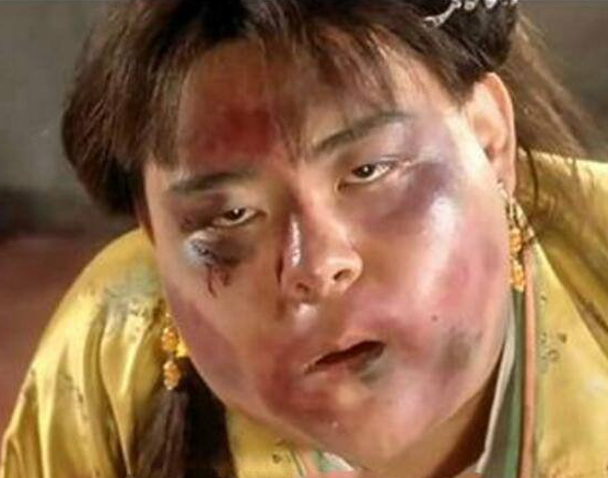 吸脂是否真的可以做到直角腰,筷子腿?