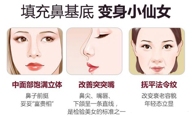 如何改良鼻基底凹陷?【鼻基底知识】