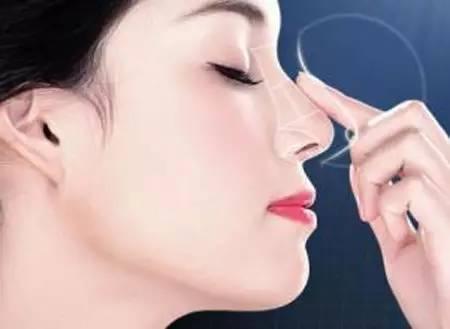 上海刘俊隆鼻技术怎么样?【案例|点评】