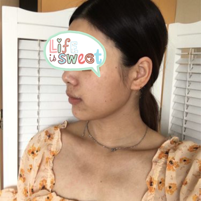 上海喜美周达医生技术怎么样?【案例|点评】