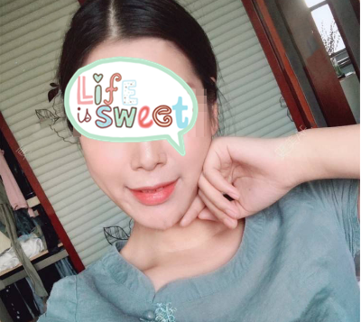 上海喜美周达医生技术怎么样?【案例|点评】