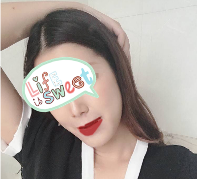 上海喜美周达医生技术怎么样?【案例|点评】
