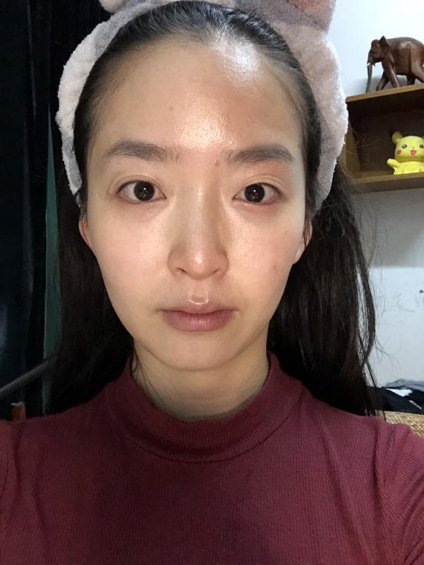 曹仁昌做眼部修复风格怎么样?【案例|盘点】