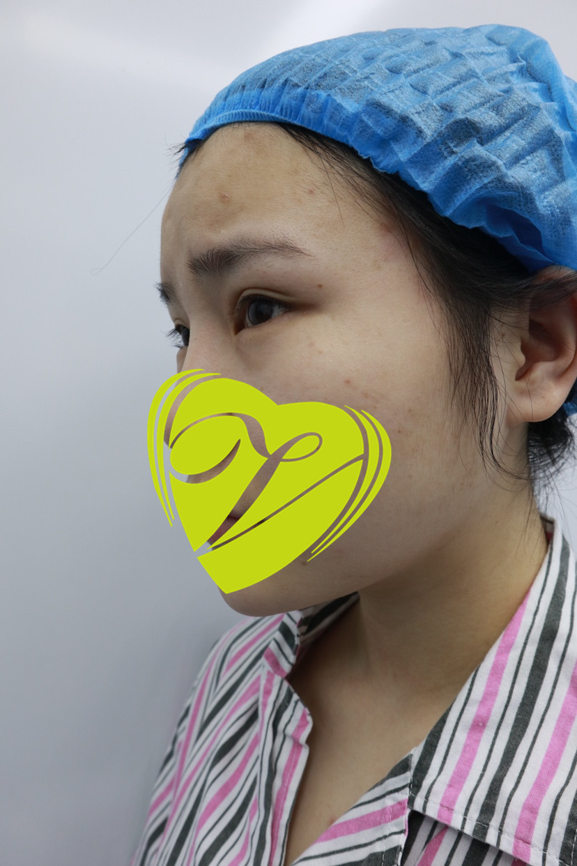 紫馨面诊谷琪做眼部修复风格怎么样?【案例|盘