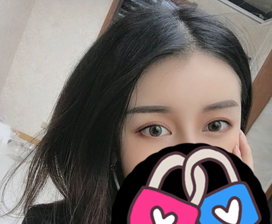 张霞做双眼皮手术风格怎么样?【案例|盘点】