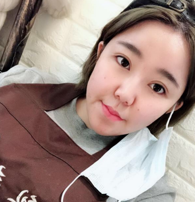 斯美诺张宁教授做修复手术风格怎么样?【案例
