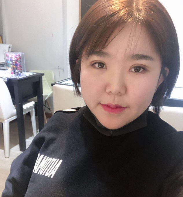 斯美诺张宁教授做修复手术风格怎么样?【案例