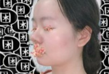 觉得鼻子很大怎么改良比较好?