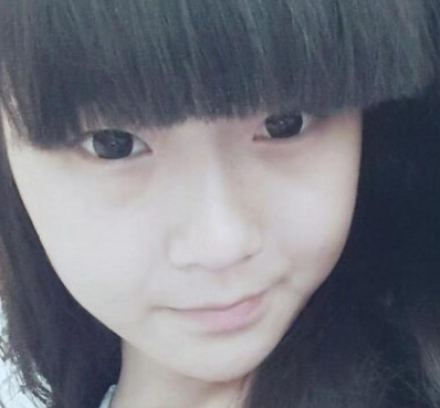 大连美天张井忠、爱德丽格刘志刚双眼皮谁好?