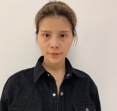 上海光博士医疗美容医生李彬眼部多项分享!