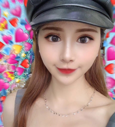 上海光博士医疗美容医生李彬眼部多项分享!