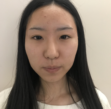 北京美莱医疗美容光纤溶脂瘦脸果怎么样？