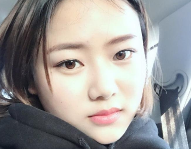 成都美诗沁医疗美容注射瘦脸案例分享！