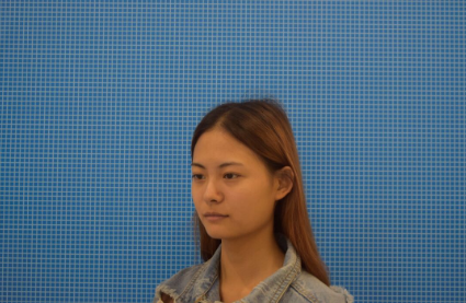 北京壹加壹医疗美容门诊部硅胶隆鼻果如何？