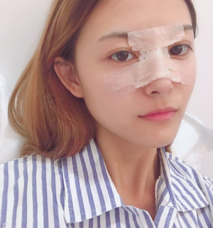 北京壹加壹医疗美容门诊部硅胶隆鼻果如何？