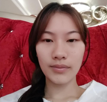 【双眼皮案例】广东美恩整形切开双眼皮果