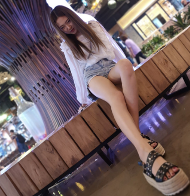 北京达美如艺医生秦继锋大腿吸脂案例分享!