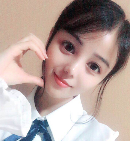 怀化韩美医疗美容医院隆鼻案例分享！