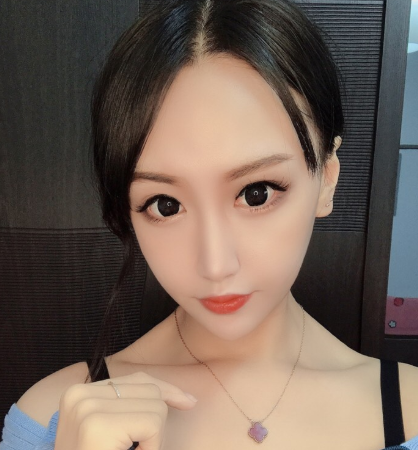 上海光博士医疗美容医生李彬眼部多项案例分享