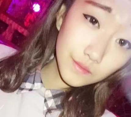 汕头华美医美医院切开双眼皮案例分享!