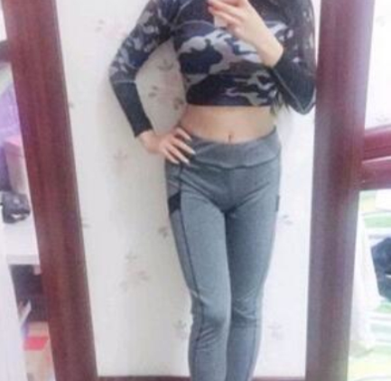 重庆艺星整形腰腹吸脂术后分享,术前术后恢复
