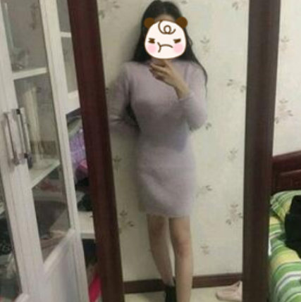 重庆艺星整形腰腹吸脂术后分享,术前术后恢复
