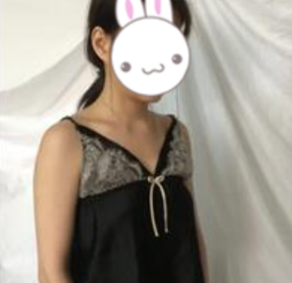 西安壹加壹医美假体隆胸术后100天分享!