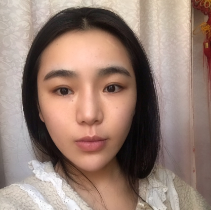 上海光博士医生李彬热拉提案例分享!