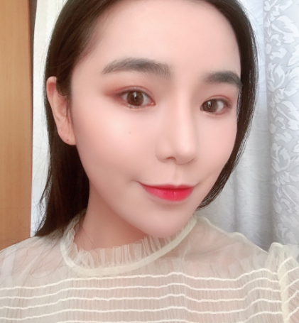 上海光博士医生李彬热拉提案例分享!