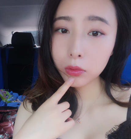 苏州肤康皮肤科医院点阵激光案例分享!