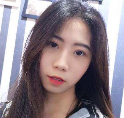 深圳瑞利医疗美容门诊部埋线提升提升案例分享!