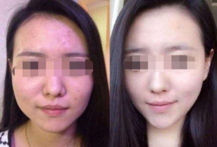 下颌角手术之前是否需要进行多方面的身体检查?
