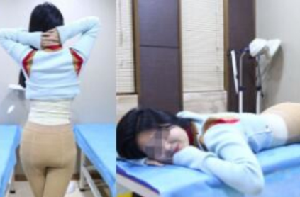 北京华韩医疗美容腰腹吸脂术后分享带果图!