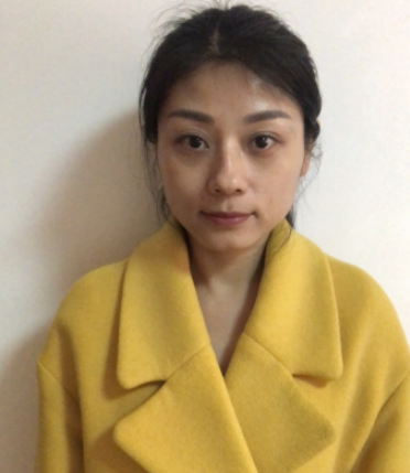 上海光博士医疗美容热玛吉术后果分享!