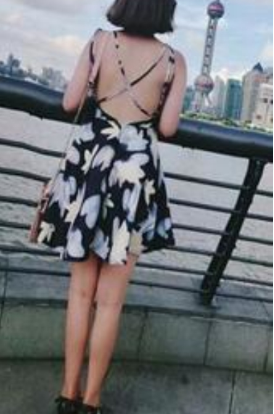 郑州悦美医美大腿吸脂果怎么样?