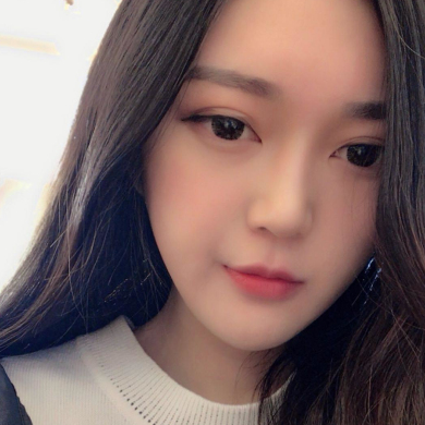 上海薇琳医疗美容医院面部吸脂术后100天果